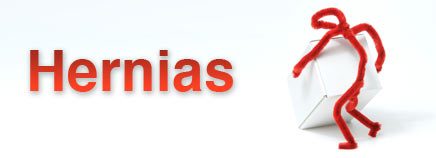 4 CONTRIBUTING FACTORS OR CAUSES OF HERNIAS